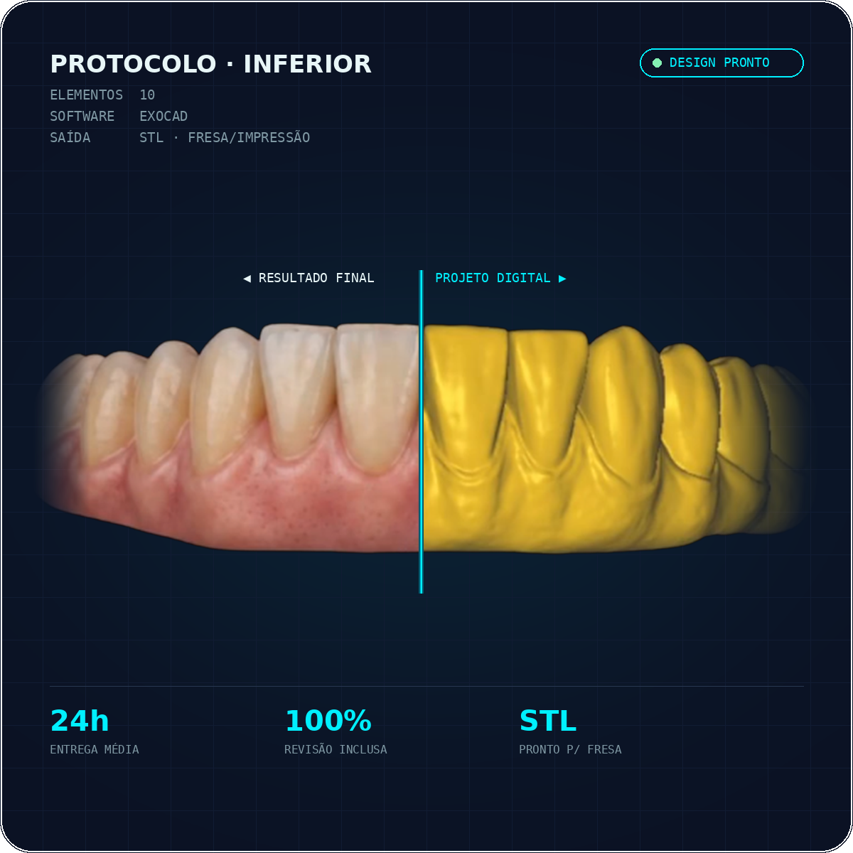 Protocolo inferior: resultado final e projeto digital no Exocad