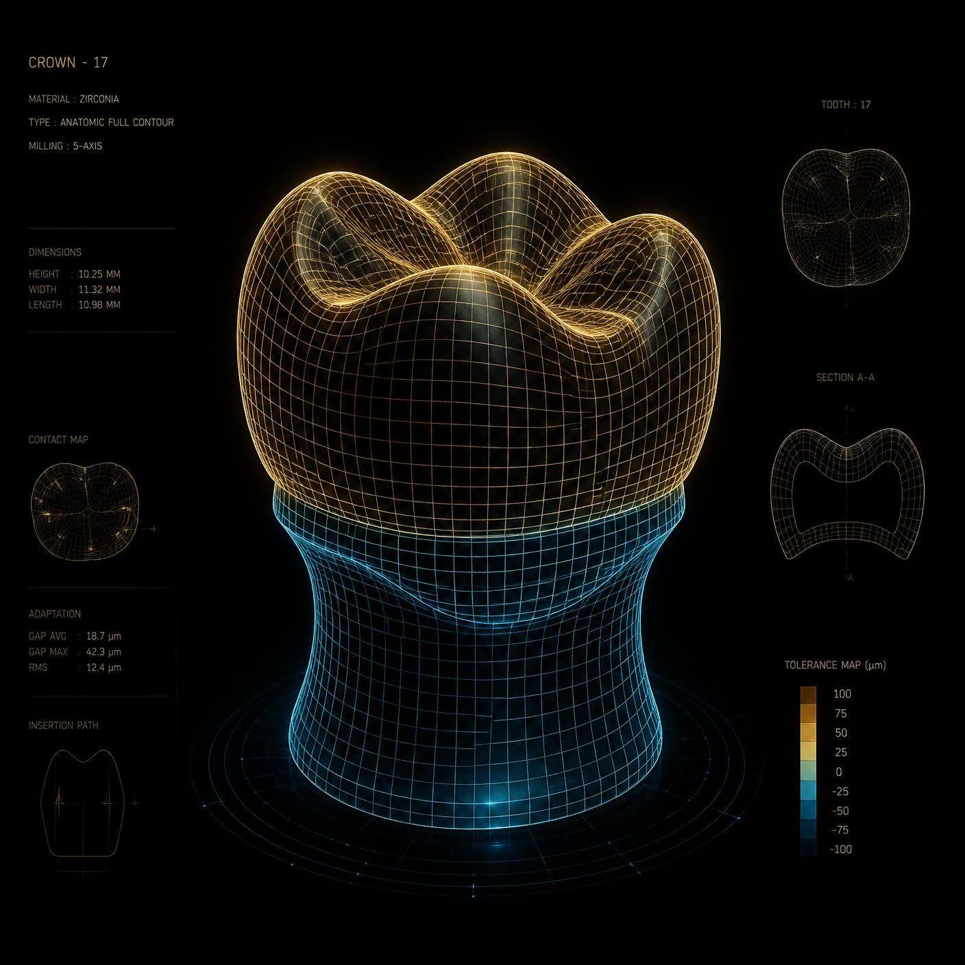 Malha 3D de coroa dental em software CAD com linhas douradas e ciano